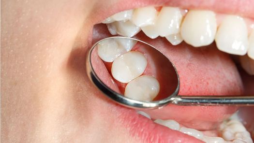 Zahnbehandlung - Zahnarztpraxis Dr. med. dent. Hans-Peter Warnberger aus Friedberg